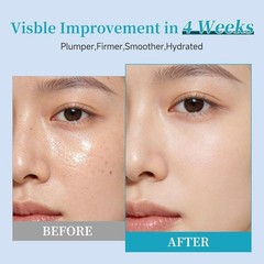 BACHERI Collagen Peptide Serum Anti-Aging 30 Ampoules 1.5ml