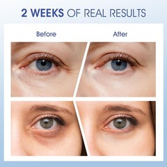 Eye Cream for Wrinkles, Fine Lines & Crows Feet – With Ceramides, Peptides + …