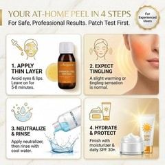 Ane Lumiere 30 Salicylic Acid Peel Chemical Peel Kit Acid Peeling For Face