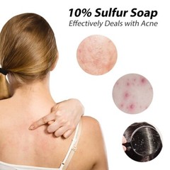 10pks Sulfur Soap 4.4ozx10 Oil Control Acne Deep Cleanser Skin Care Health