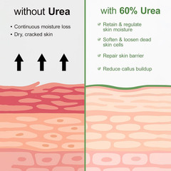 Urea Cream 60 Percent for Feet Maximum Strength plus Salicylic Acid 2%, Tea Tree