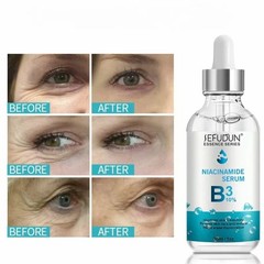 Niacinamide 10% Facial Serum Skin Brightening Dark Spots Eraser, 30ml [USA Stock