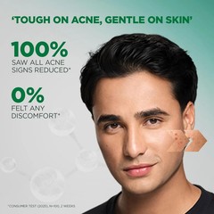 Garnier Men Acno Fight Gentle Cleanser Facewash Sensitive Male Skin 100g
