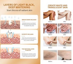 Mooyam dark spot corrector cream, Suitable for intimate areas.