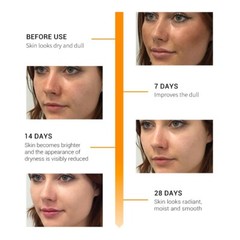 Matrixyl 3000 Peptide Hyaluronic Acid Retinol Collagen Vitamin C Cream – 2oz