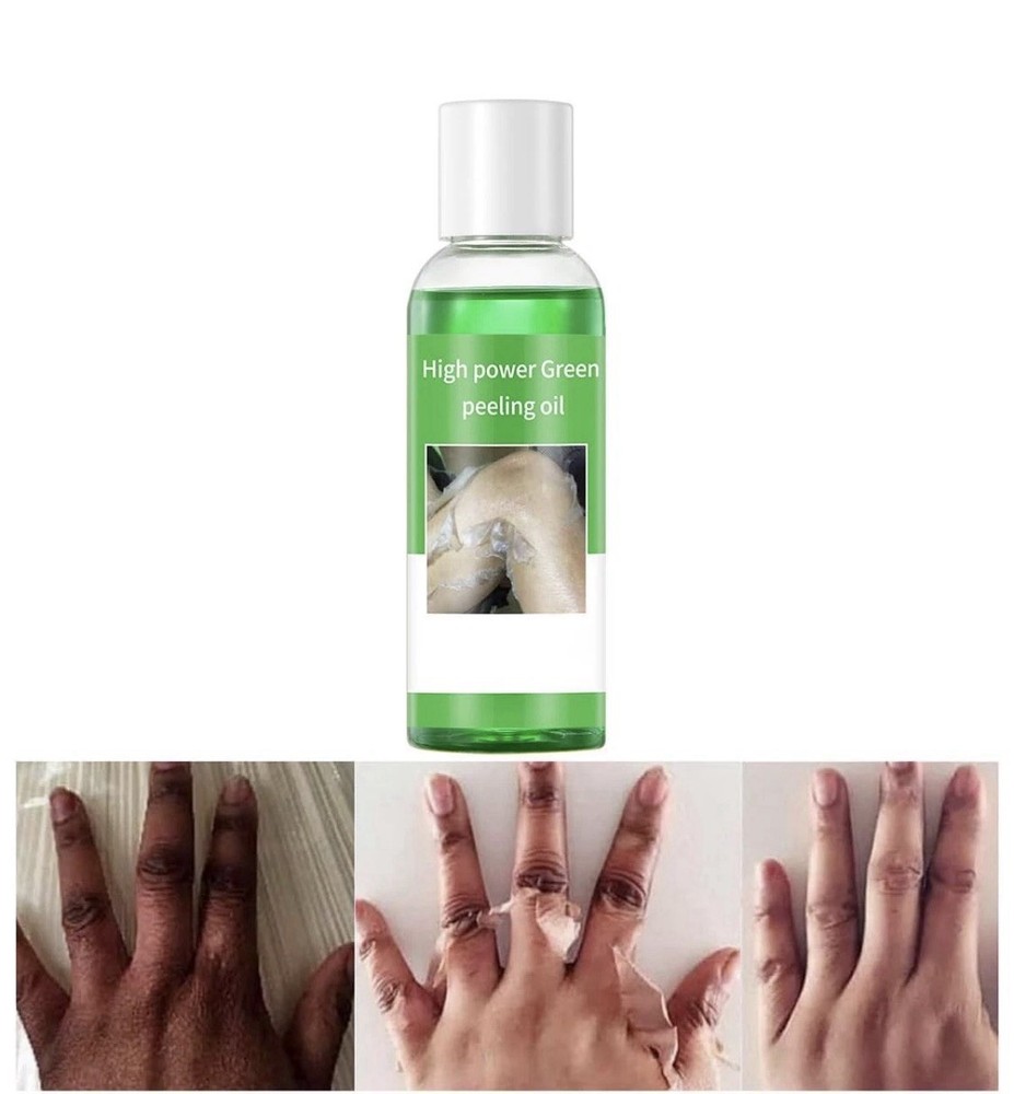 Peeling Oil for Dark Skin, Green Oil, Facial 3.52 Fl Oz (Pack of 1)