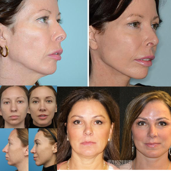 Neck Firming Cream to Reduces Wrinkles Skin Helps Tightening 50gm