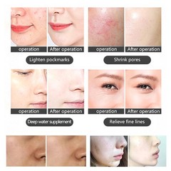 7Colors BIO PDT LED Light Photon Therapy Facial Skin Rejuvenation Beauty Machine