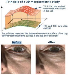 E y e l i s s EYE BAGS & PUFFINESS REMOVER PEPTIDE – 20ML
