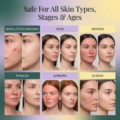 Jusspray™ Hypochlorous Acid Spray for Face and 4 Fl Oz (Pack of 1), Clear