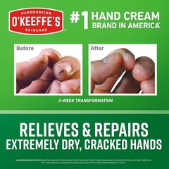 O&rsquo;Keeffe&rsquo;s Working Hands Hand Cream for Extreme Dryness – 6.8 oz Value Size J…