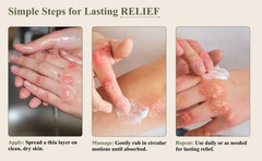 Dead Sea Psoriasis Cream – Moisturizing Cream for Psoriasis & Itchy Skin JORDAN