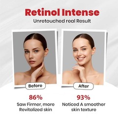 Bio Mystery Retinol Intense Night Cream 0.1% with Collagen & Peptide – 40 gm