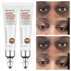 2PCS Eye Cream Firm Eye Tightener Remove Eye Bags Dark Circles Wrinkle Depuffing