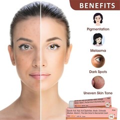 Cream for Unisex Helps to Remove Acne Scar Dark Age Spots Uneven Skin Shade 20gm