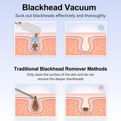 Ultra Pro Blackhead Remover Vacuum Electric Pore Cleaner Acne Black Dot Tool USB