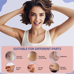 Painless Skin Tag Remover Device Kit Auto Safe Removal 1-9 MM Band Tool Home Use