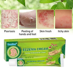 5 Pcs X Eczema Natural Herbal Cream Skin Treatment
