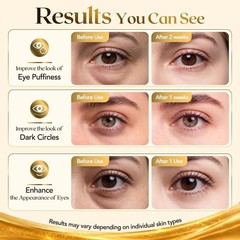 80 PCS 24K Gold Collagen Under Eye Patches & Smile Line Patches