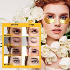 24K Gold Under Eye Patches – 30 Pairs, Treatment for Dark Circles & Puffy Eyes