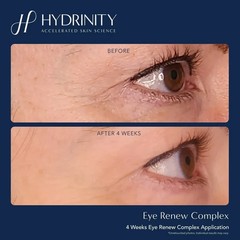 Eye Renew Complex-delivers powerful hydration to the delicate skin around your.
