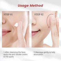 Whitening Freckle Cream for Dark Spots, Melasma & Pigmentation, 20g