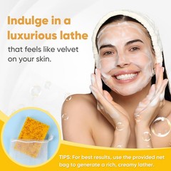 Treeroot 5 Pack Turmeric Soap, 80g Kojic Acid and 1 Count (Pack of 5)