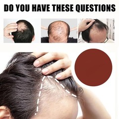 2 pcs Kormesic 5% Hair Growth Scalp Massage Cream Professional Hair Care100g