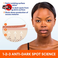 Palmer&rsquo;s Skin Success Anti-Dark Spot Fade Cream for All Skin Types, 2.7 Ounce