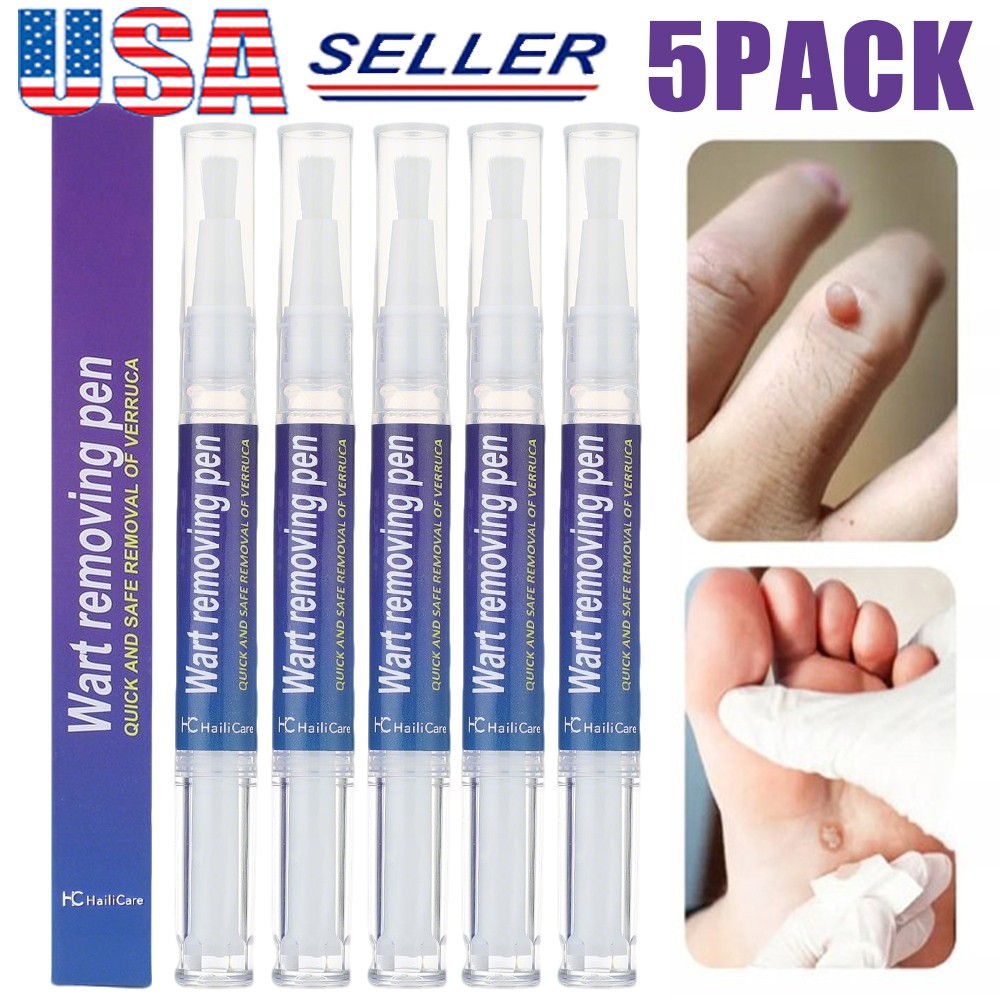 5X 5ml Warts Removal Pen Eliminate Wart Pen Wart Liquid Hand Foot Warts Remove