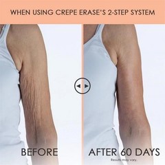 Body Body Crepe Erase Firm Repair Treatment 10 oz