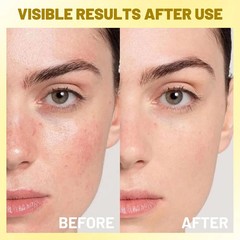 Deep Vitamin C Hydrating Face Cream Capsules, 4.9 OZ Moisturizer