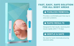 Painless Skin Tag Remover Device Kit Auto Safe Removal 1-9 MM Band Tool Home Use