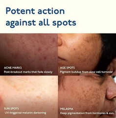 Asaya Advanced Dark Spot Targeting Gel Hyperpigmentation & Scars all skin 15g d8