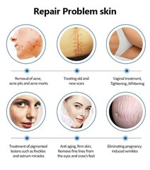 Skin Tightening Laser Co2 Fractional Laser Machine Skin Scar Removal Renewal