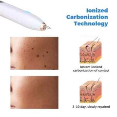 Electric Laser Plasma Pen Mole Removal Dark Spot Remover Skin Wart Tag Tattoo