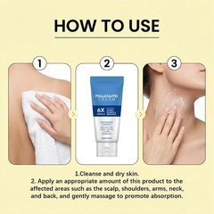 Folliculitis Treatment Cream: Effective Treatment for Folliculitis Scalp