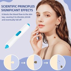 Painless Skin Tag Remover Device Kit Auto Safe Removal 1-9 MM Band Tool Home Use