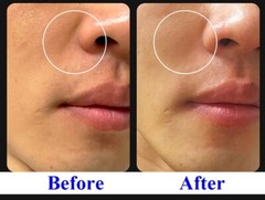 WHITESILK Retinaldehyde (4000ppm) & Bakuchiol Anti-Wrinkle SUPER Cream (30ml)