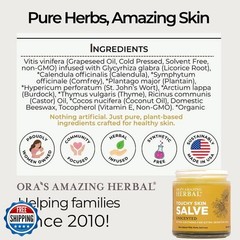 Ora&rsquo;s Amazing Herbal, Touchy Skin Salve, Eczema Cream Treatment, Anti-Itch Cr