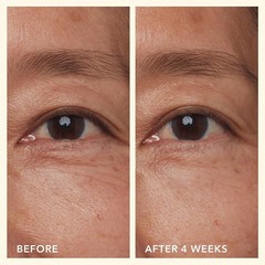 Mushroom Goat Milk Eye Cream – Clinically Proven Anti-Aging Eye Treatment for…