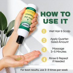 Ovante Acne Zap Shampoo 7oz Scalp Acne & Dandruff Treatment