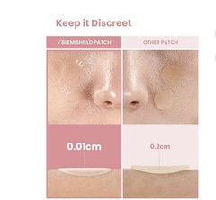 GLAM UP Spotless Smart Patch Hydrocolloid Acne Patches Waterproof Matte 36 ct
