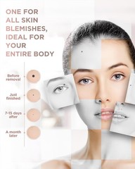 Lapiz Dispositivo Maquina Laser Para Remover Eliminar Verrugas Profesional TOP