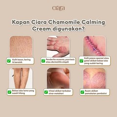 CIARA Chamomile Calming Cream 100ml for Scar Stretch Mark Treatment