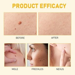 Bee Venom Skin Restoration Cream, Professional Bee Venom Skin Cream,deeply …..