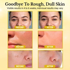 turmeric kojic acid cleansing pads