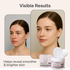 Glycolic Acid 20% Resurfacing Pads (50 Count), Exfoliating Peel Pads for Face, S