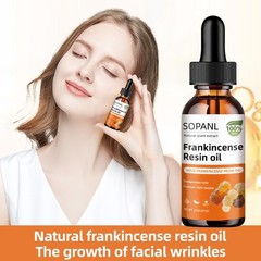 Organic Frankincense Resin Oil – Reduces Fine Lines & Wrinkles 2 Fl Oz