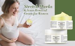 Stretch Marks and Scars Removal Cream for Pregnancy
